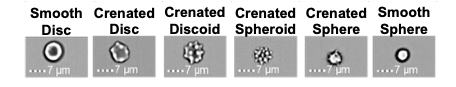 Six shapes of red blood cells