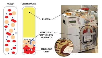 Illustration of blood before and after Centerfuge