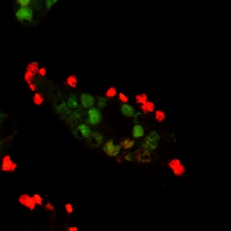 Red blood cells that have been ingested by the macrophage (immune cells) are stained in green and red blood cells that are bound but not ingested by the macrophage are stained red. The orange color is a cell membrane staining dye. 