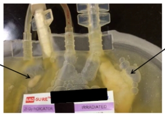 bacterial visible in platelet