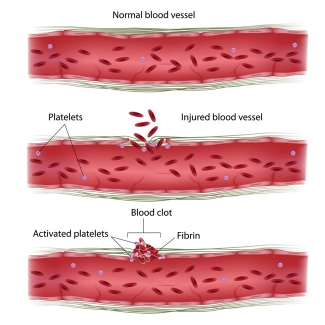 how platelets form clots