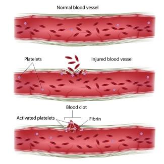 how platelets form clots