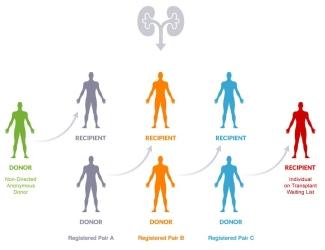 Kidney Paired Donation - how it works