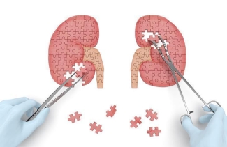 kidney piece puzzle