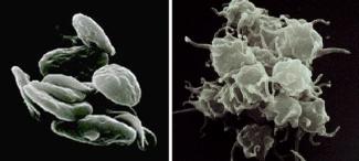 Resting platelets (left); inactivated platelets (right).