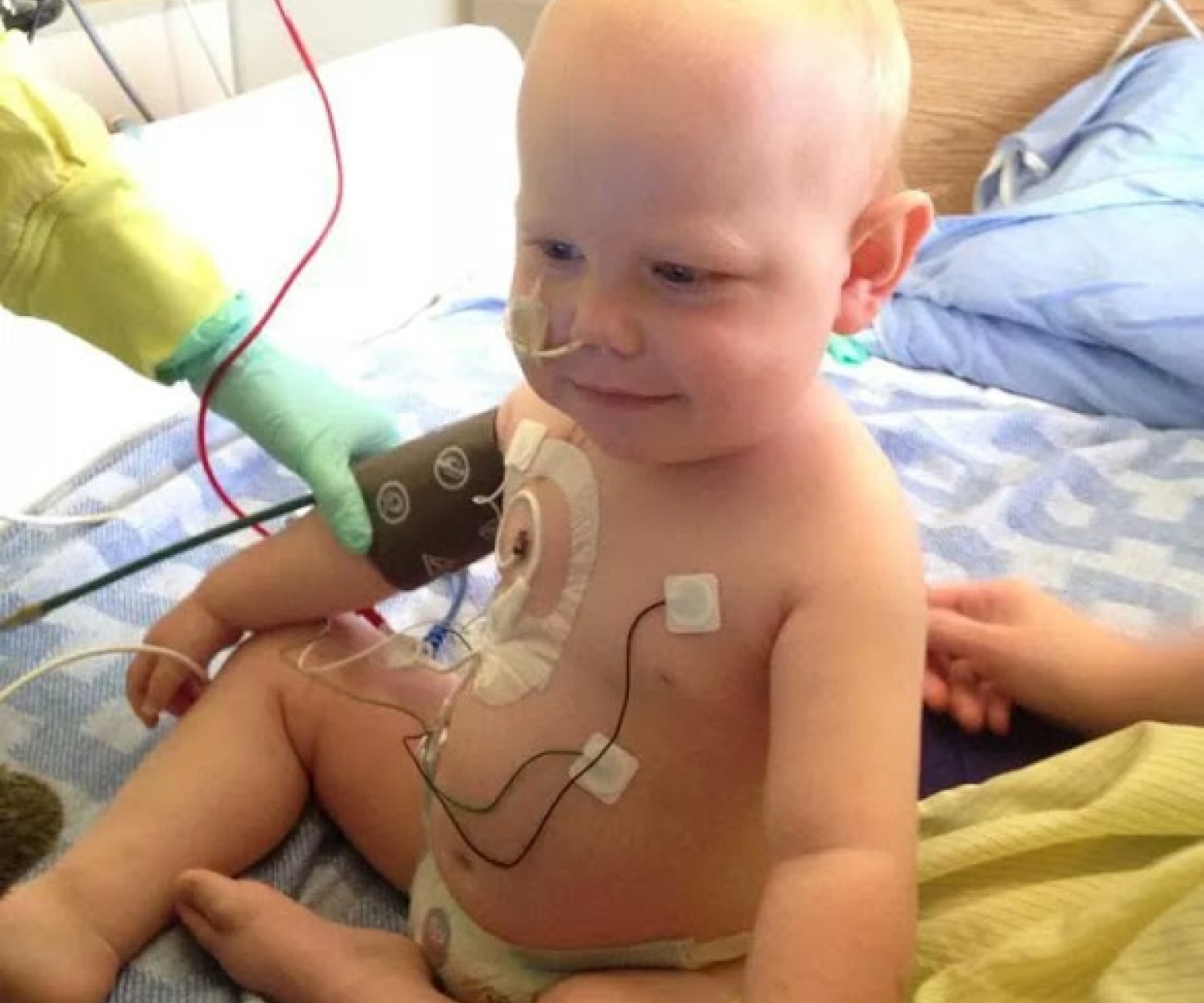 Baby in hospital with tubes