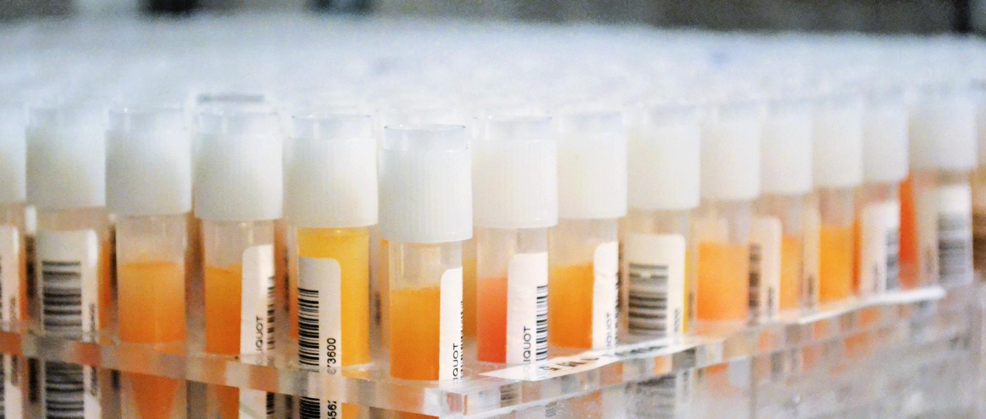 Image of vials of plasma being prepared for testing with orange substance in the tubes.